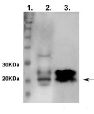SOC1 | Suppressor of constans overexpression 1 in the group Antibodies Plant/Algal / DNA/RNA/Cell Cycle / Transcription regulation at Agrisera AB (Antibodies for research) (AS12 1856)
